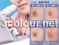 Skin Diagnostics Sys[NAUMP]:Skin Diagnostics System is a complete system for cosmetic skin counselling offering measurement, include a skin microscope, a Skin Moist Senser and software. The Skin & Hair diagnosed result by the program will provide trusty data to the customers.- Popteam Ventures